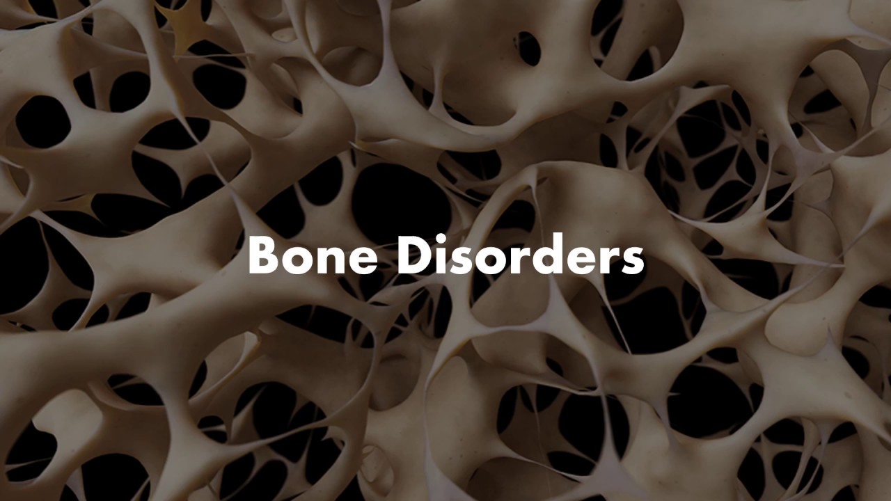 Bone Disorders