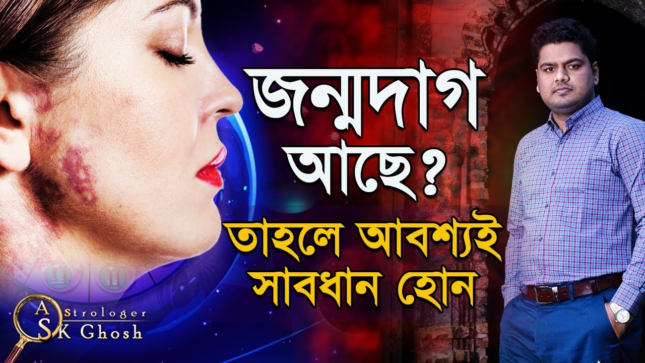 জন্মদাগ বা জরুল চিহ্ন আছে? তাহলে অবশ্যই সাবধান হোন। Astrologer-S.K.Ghosh | Astrology tips bangla