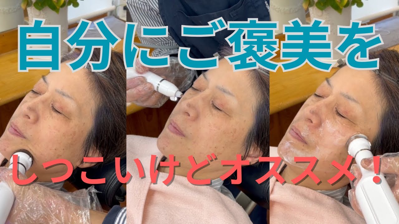 【シミケアに黒ずみケア】欲張りにどっちもケア。
