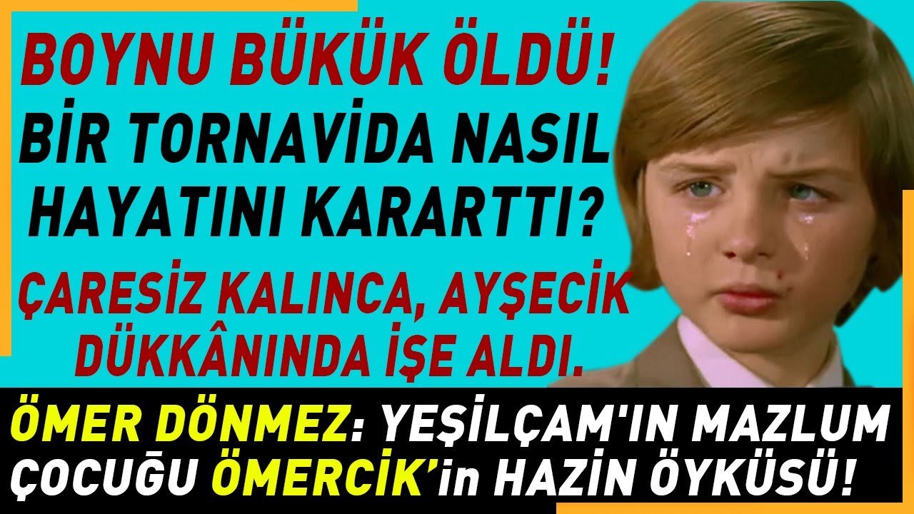 &Ouml;MERCİK:Sol g&ouml;z&uuml;n&uuml; kaybetti, bir tornavida hayatını kararttı.(Yeşil&ccedil;am&rsquo;ın en g&uuml;zel y&uuml;zl&uuml; yıldızıydı)