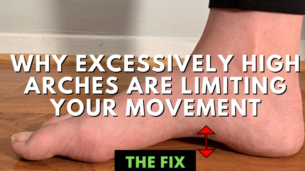 How High Foot Arches Can Limit Your Movement - The Fix