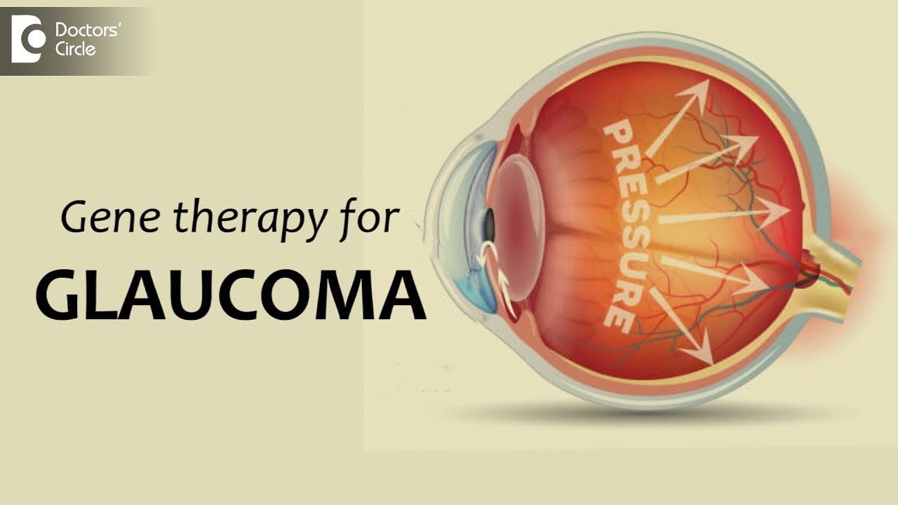 Gene therapy for glaucoma : Effective & Procedure - Dr. Sunita Rana Agarwal