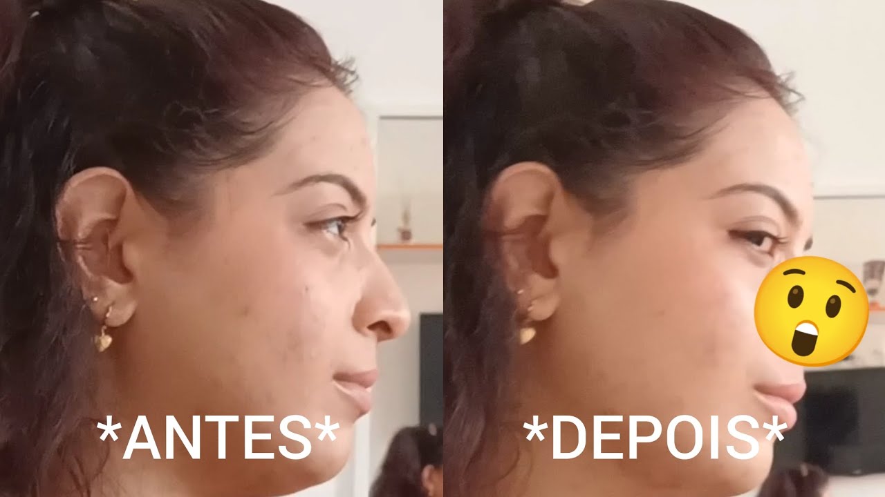 COMPREI O TAL DO 