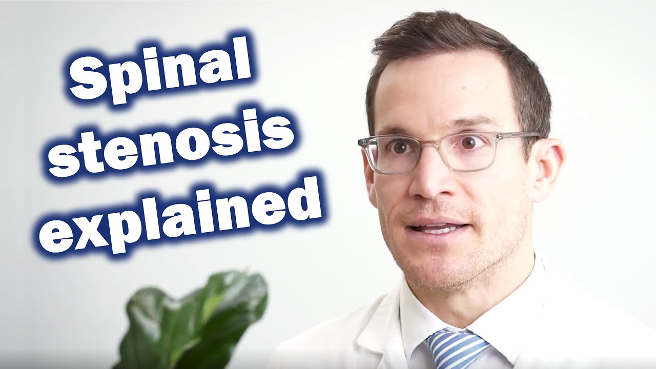 Spinal stenosis and its treatment explained by Dr. Peter Derman