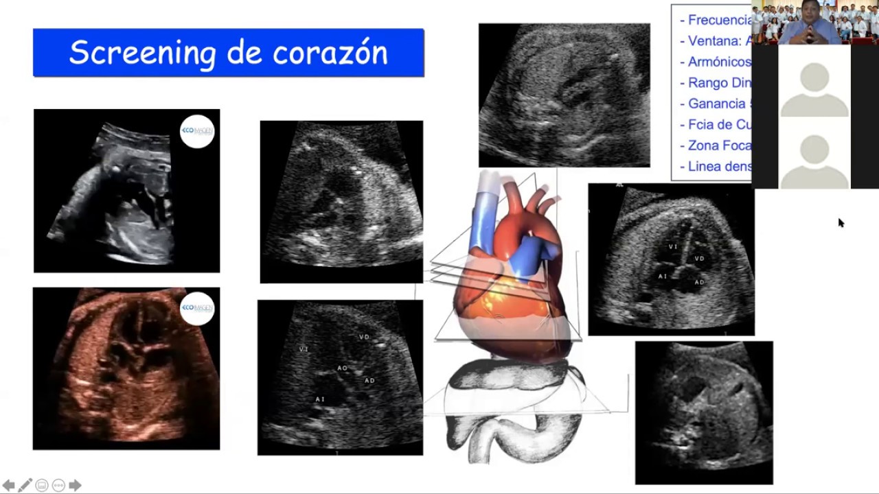 I MasterClass | Anomalías Que Sí o Sí Se Deben Diagnosticar De Forma Prenatal