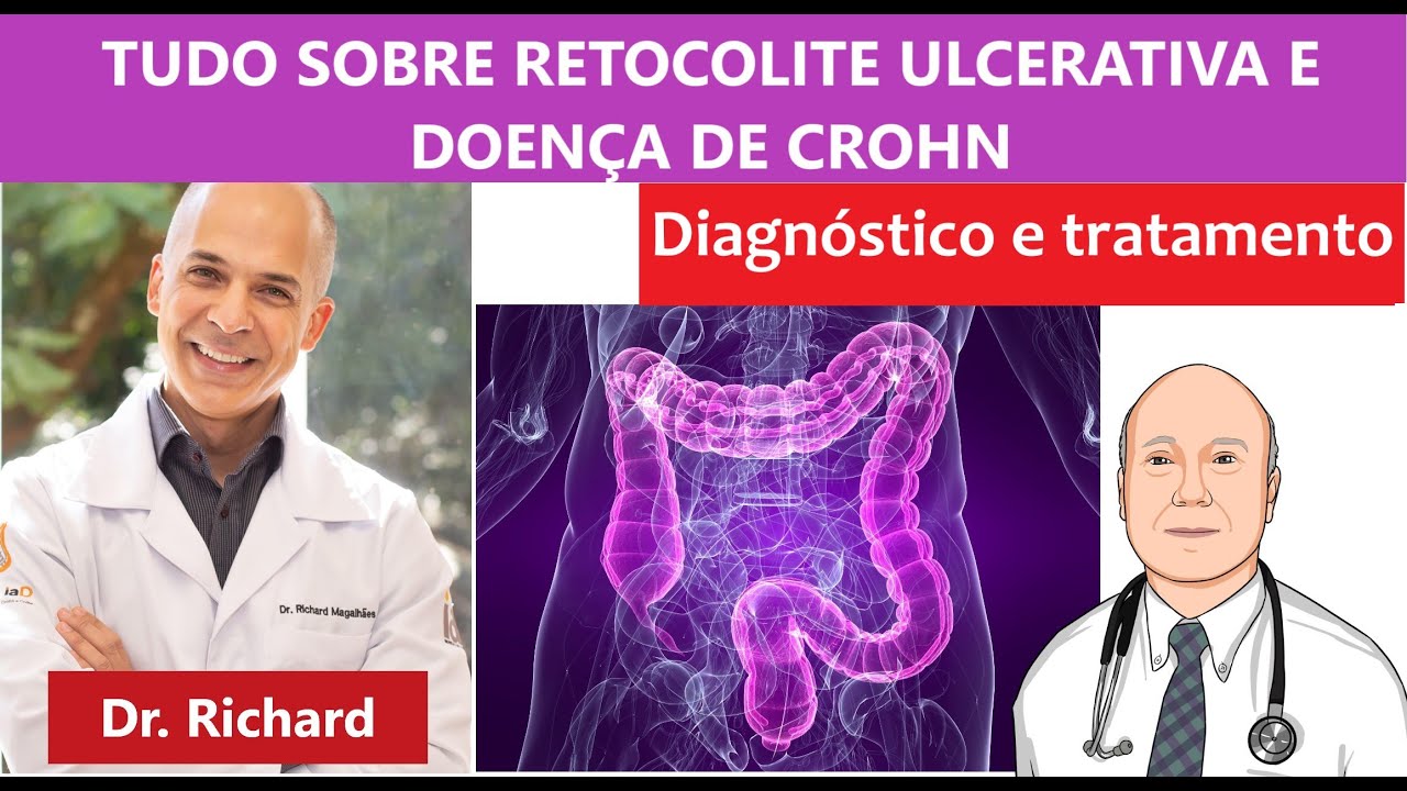 Doenças inflamatórias intestinais em detalhe: retocolite e Crohn, diagnóstico e tratamento