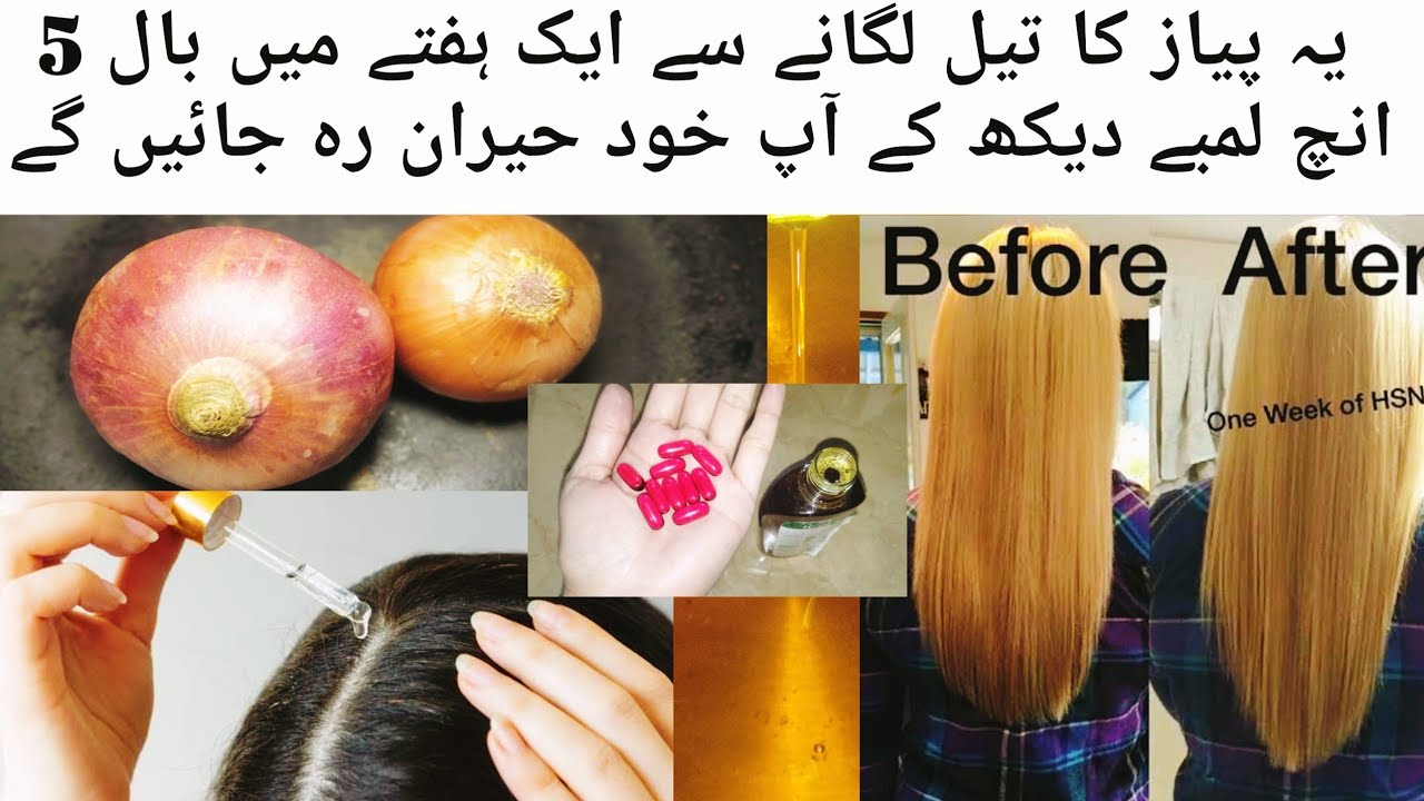 Hair Growth Oil | Make Onion Hair Oil For Faster Hair Growth And Stope Hair Fall | Homemade oil