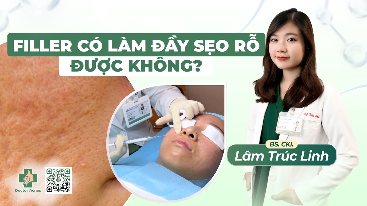 DOCTOR ACNES - FILLER CÓ LÀM ĐẦY SẸO RỖ ĐƯỢC KHÔNG?