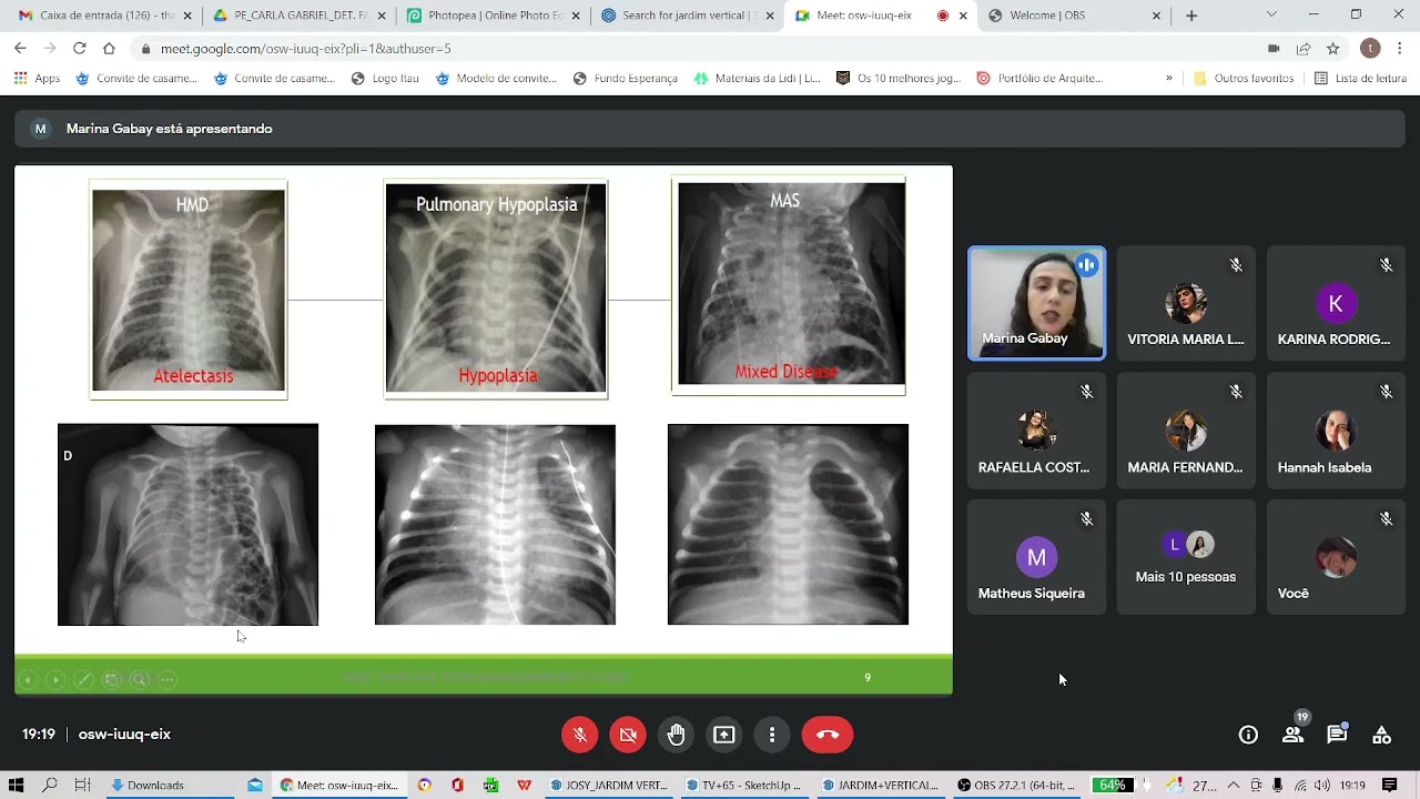Distúrbios Respiratórios do Recém-Nascido