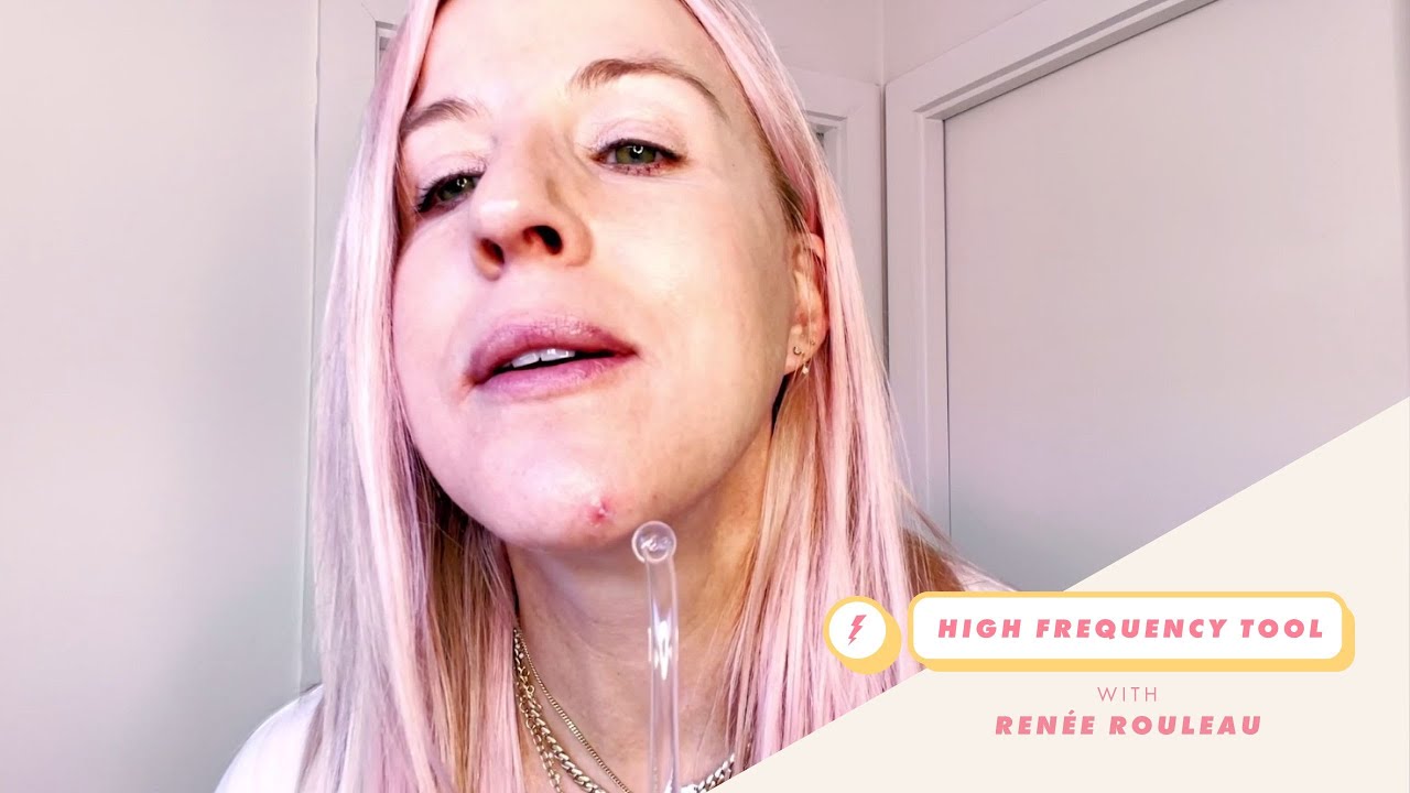 Learn How to Get Rid of Acne FAST Using High Frequency | Celebrity Esthetician Renée Rouleau
