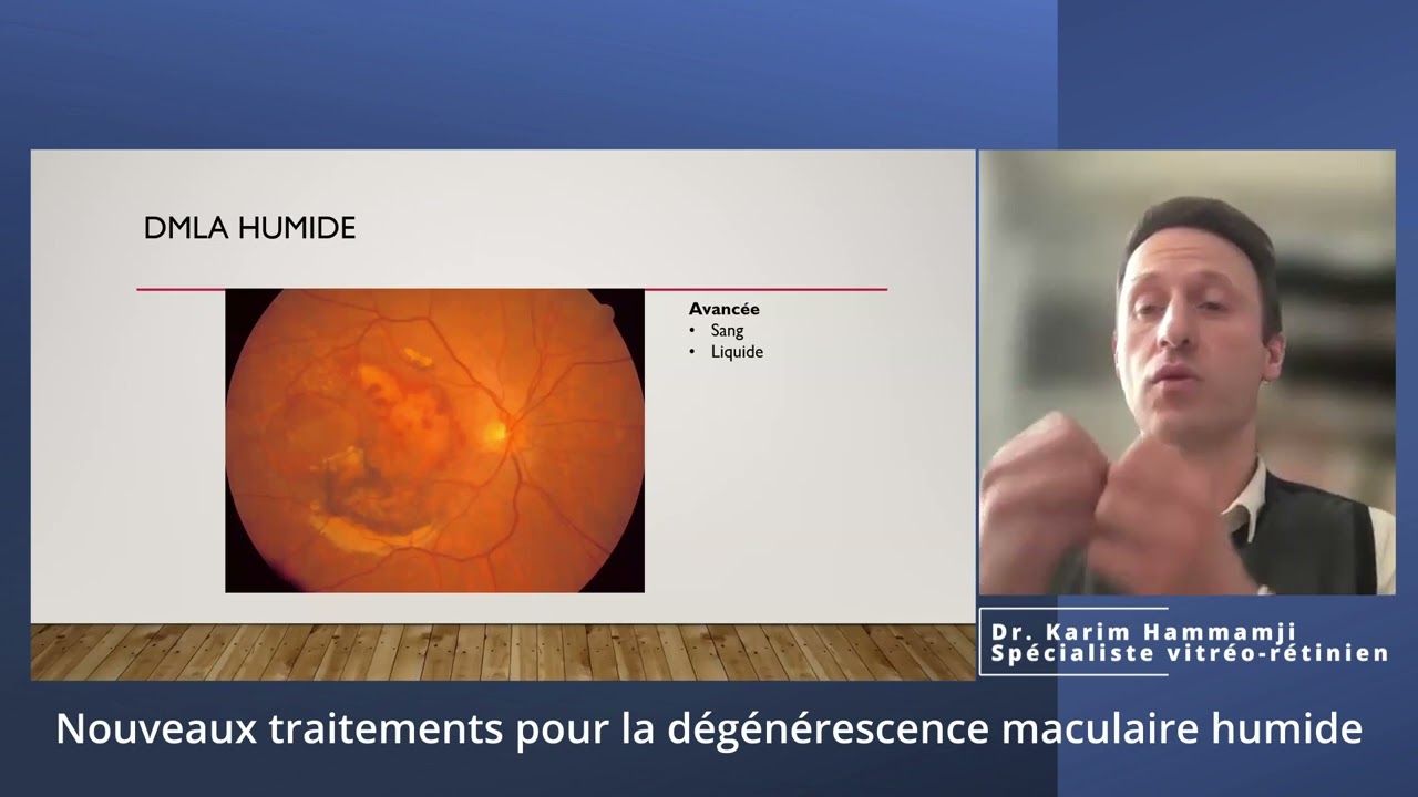 Nouveaux traitements pour la dégénérescence maculaire humide
