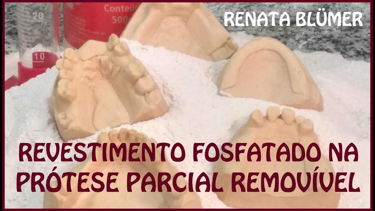 REVESTIMENTO FOSFATADO NA PRÓTESE PARCIAL REMOVÍVEL