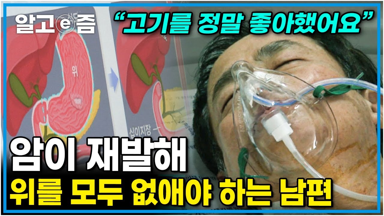 3년 전, 위의 2/3를 절제했던 남편.. 암 재발로 남은 위를 모두 제거해야 하는데.. 암 발병률 세계 1위, 한국인의 병 ‘위암’ │가족건강 프로젝트│알고e즘