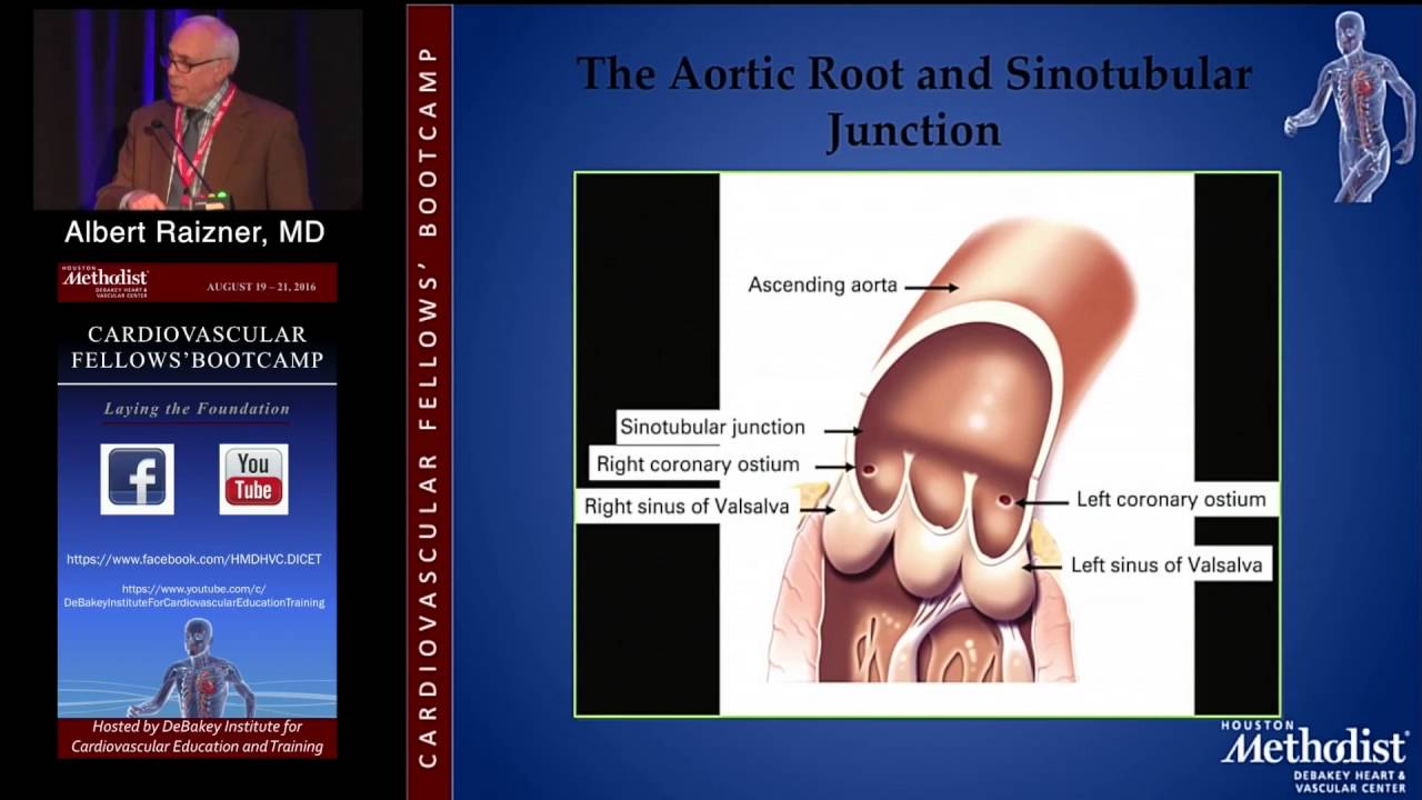 Coronary Angiography (Albert Raizner, MD) Saturday, August 20, 2016