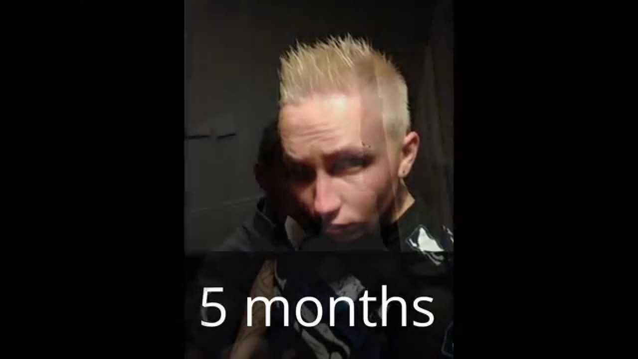 7 Months Nebido Changes