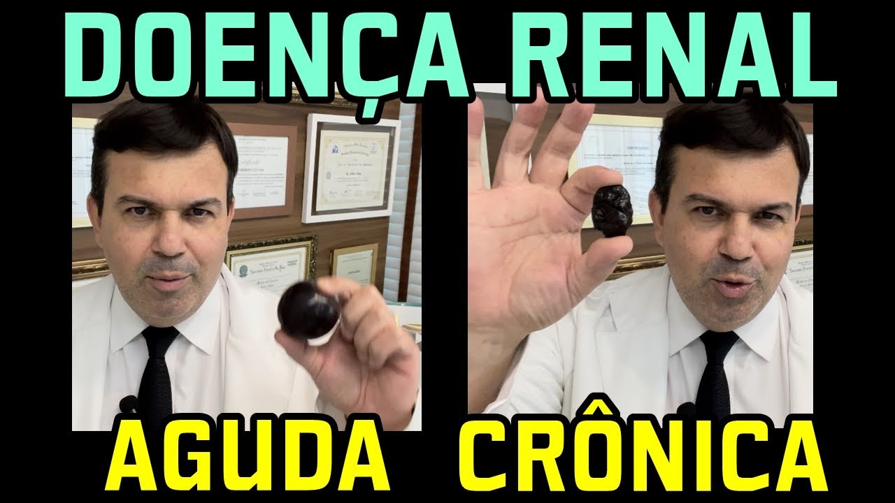 Um RIM Cr&ocirc;nico NUNCA MAIS Voltar&aacute; a Ser NORMAL