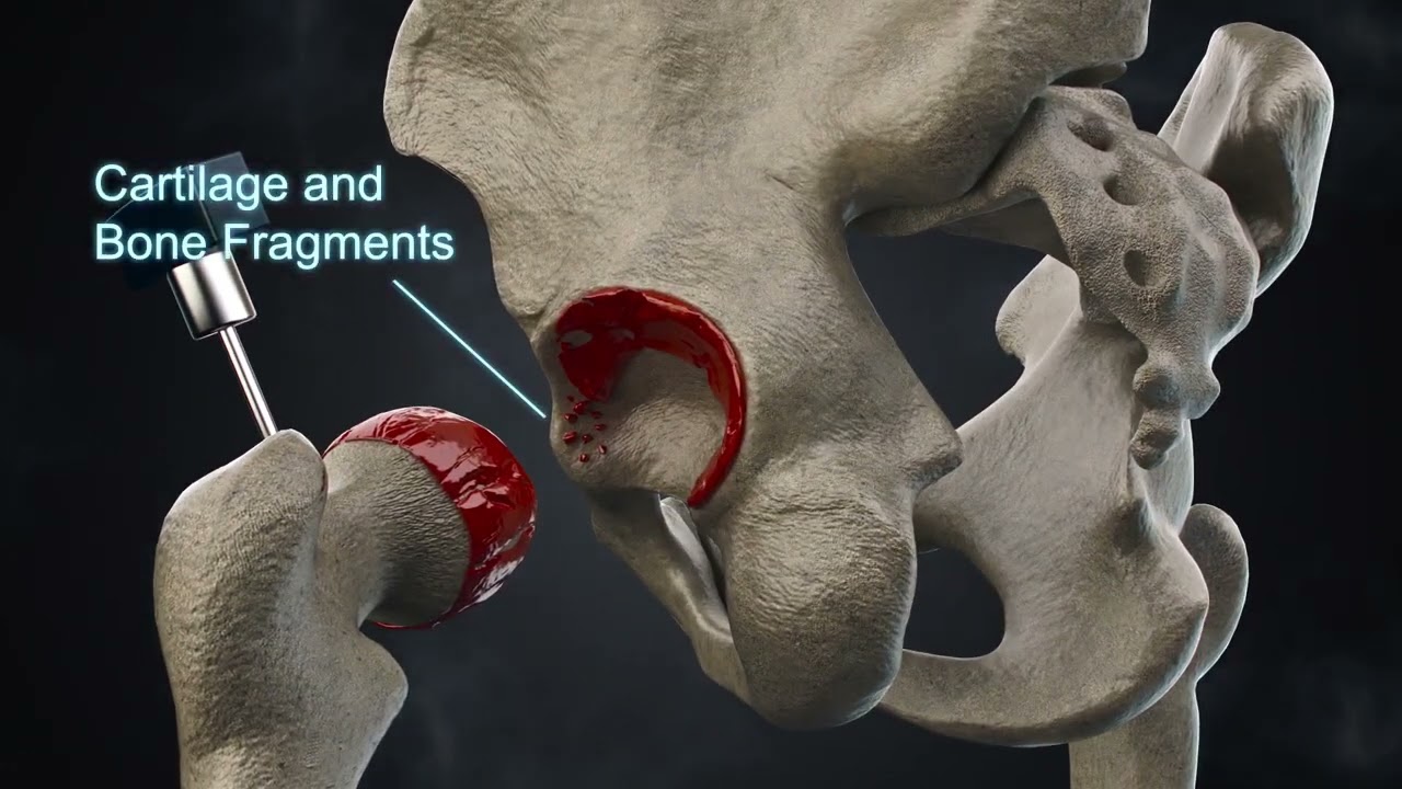 Medical Animation Segment: Expert 3D Animation | Explainer Video | California Technical Media