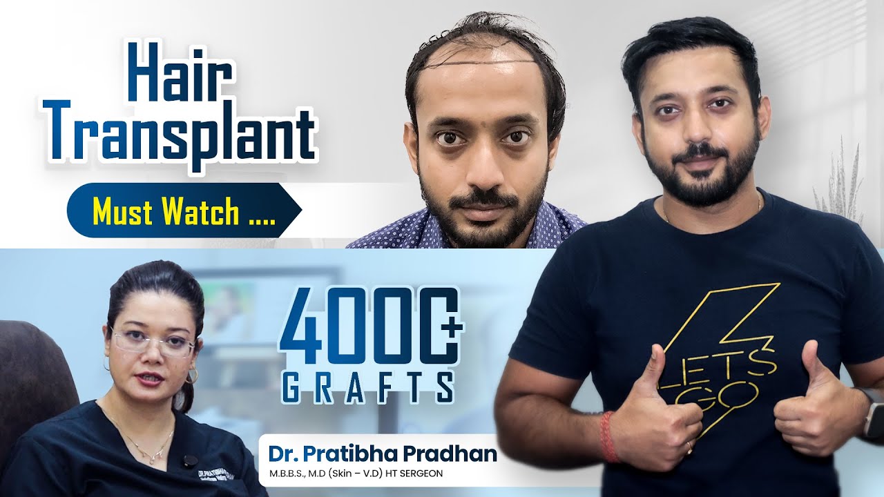 Best Hair Transplant in Kolkata | Hair Transplant Results & Best Hair Transplant Cost in Kolkata