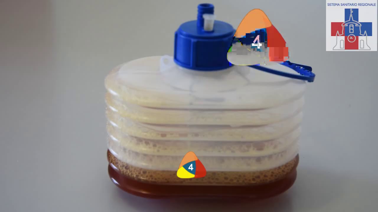 DrenaggioSenologia