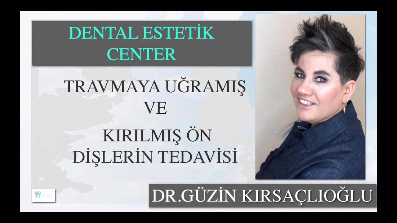 Travmaya Uğramış ve Kırılmış Ön Dişlerin Tedavisi