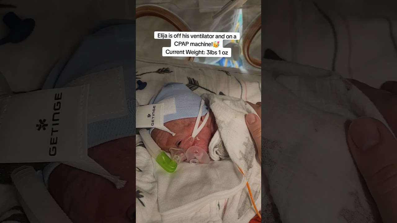 Preemie Baby Journey 