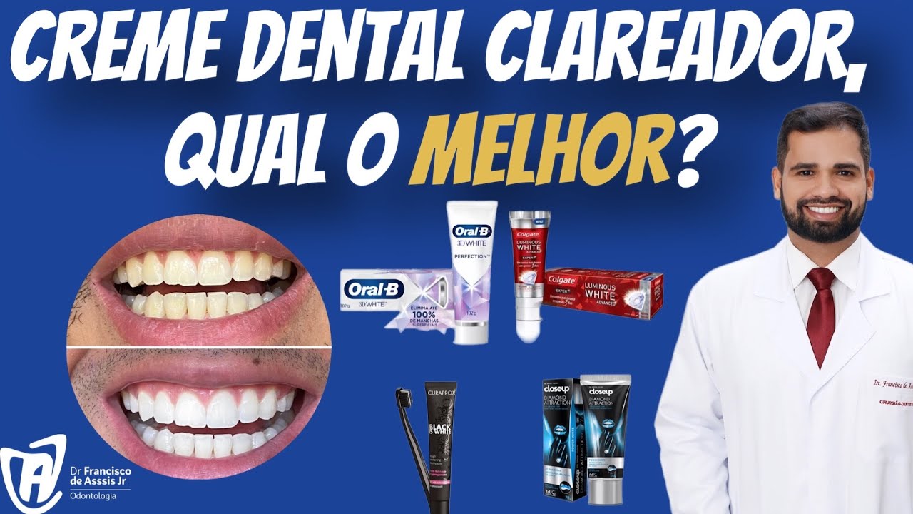 Creme dental  para CLAREAMENTO, qual o melhor? Para qual ocasião? #clareamentodental #cremedental