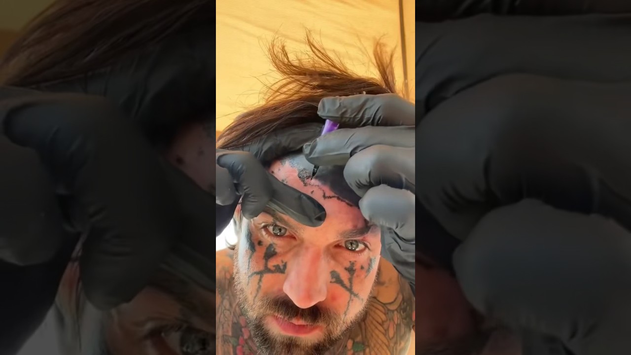 Tattooing my FOREHEAD