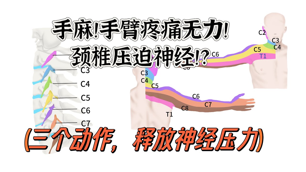 手臂疼痛，手麻无力，是颈椎压迫神经！用这三个动作来缓解神经的压力！｜悉尼脊医