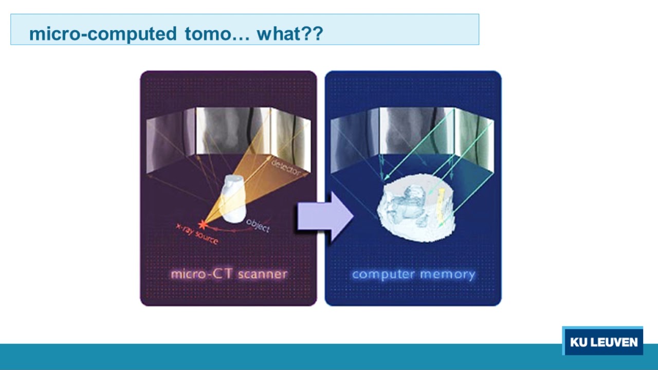 How microCT Can Provide Insight into Dynamic Disease Processes