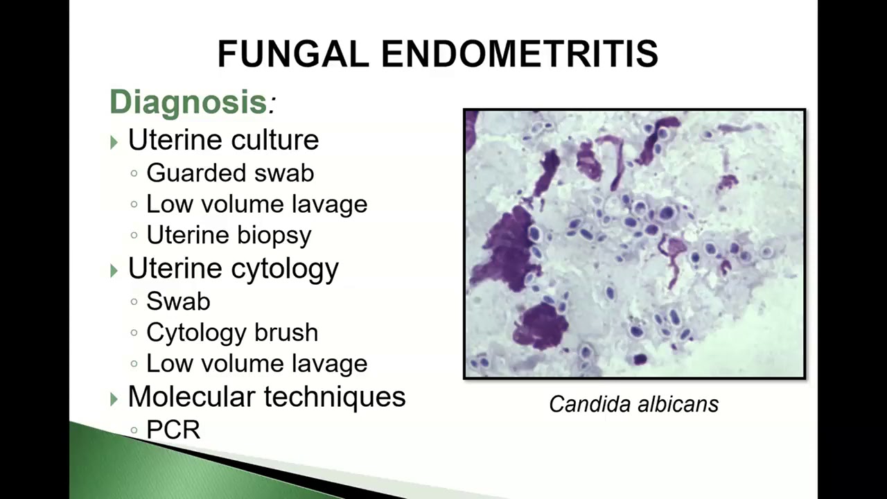 Clinical Cases in Equine Reproduction   Fungal Endometritis Vol# 3