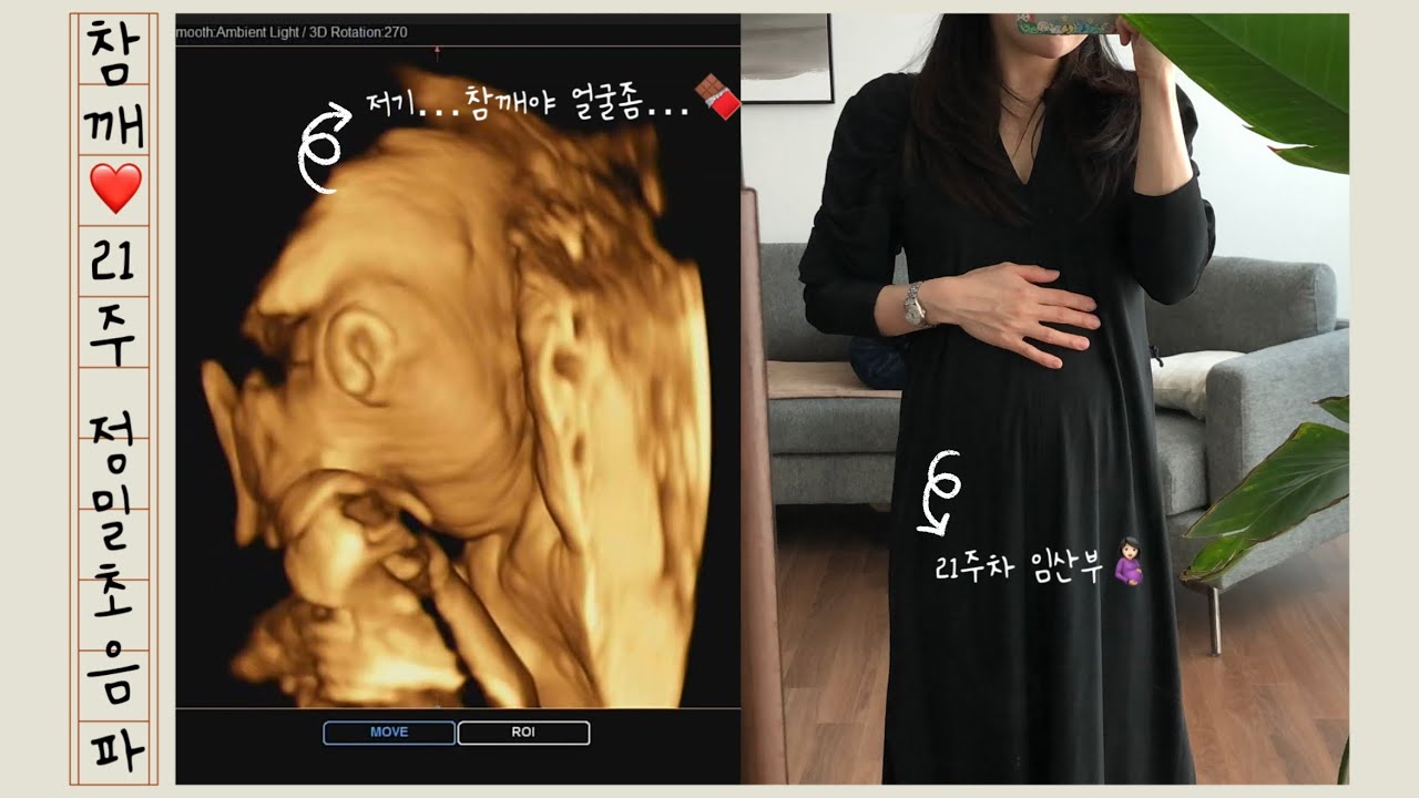 👶🏻참깨 임신 21주 정밀초음파 | 📷임신중기 입체 초음파 | 🍫참깨야 얼굴좀 보여줄래😭