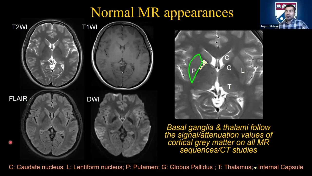Dr Mohan  presents 
