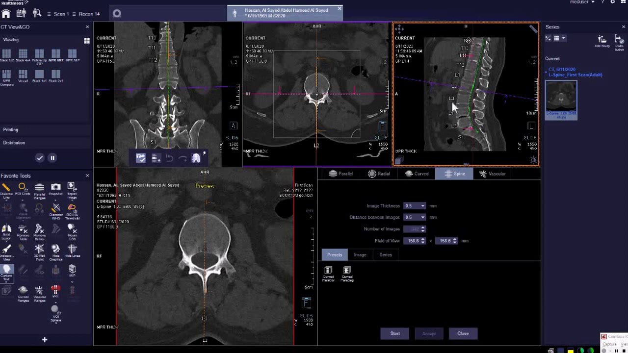 ct disk ازاى اعمل ديسكات للفقرات