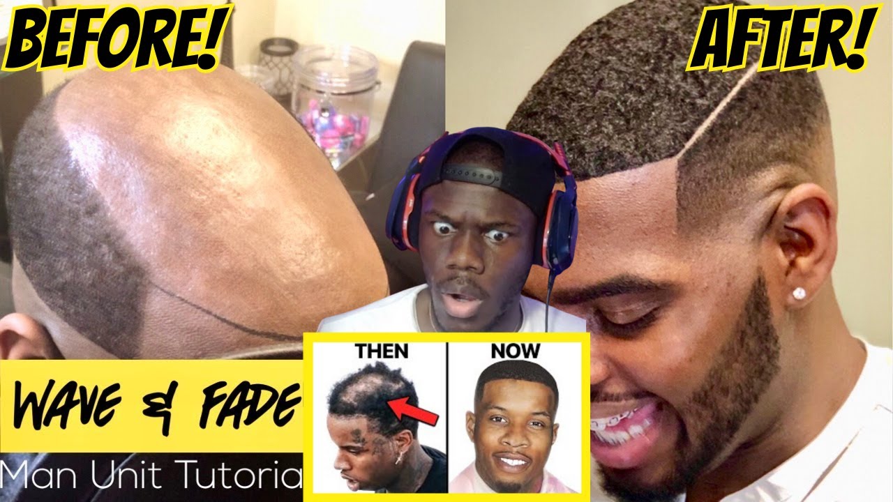 Rease Reacts To A Guy Getting A Natural Looking 