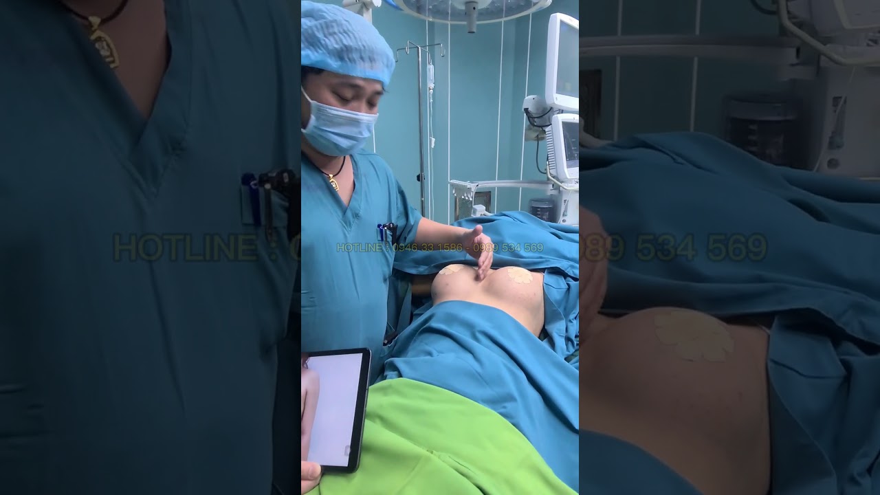 KẾT QUẢ NÂNG NGỰC ĐƯỜNG NÁCH 335CC 355CC ERGONOMIX CÙNG DR TẤN