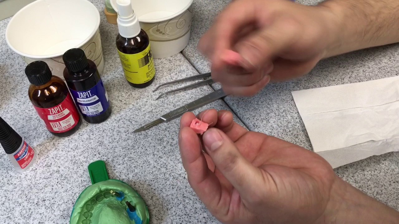 Implant Model Cast Protocol