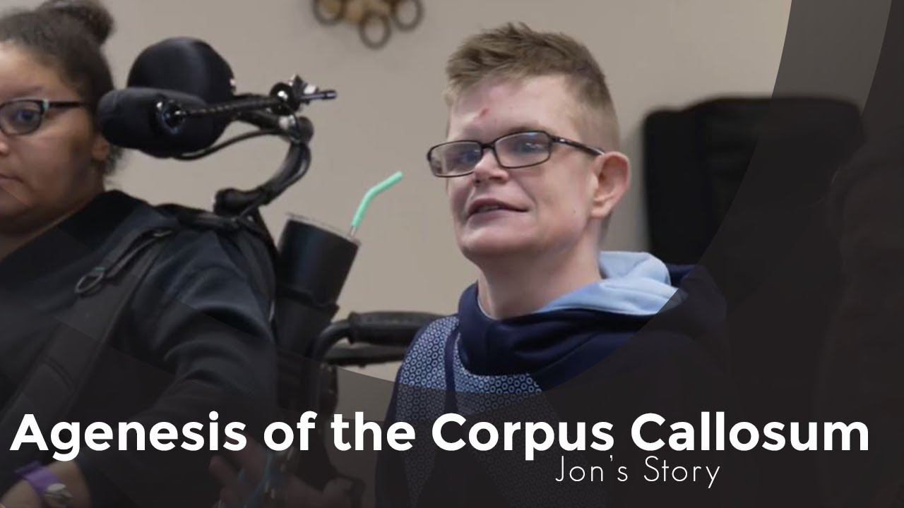 Agenesis of Corpus Callosum | Jon's Story