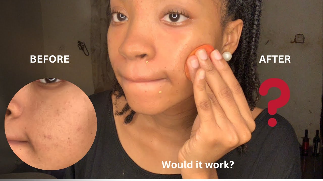 I used 🍅 Tomato on my face for a Week/ before and after