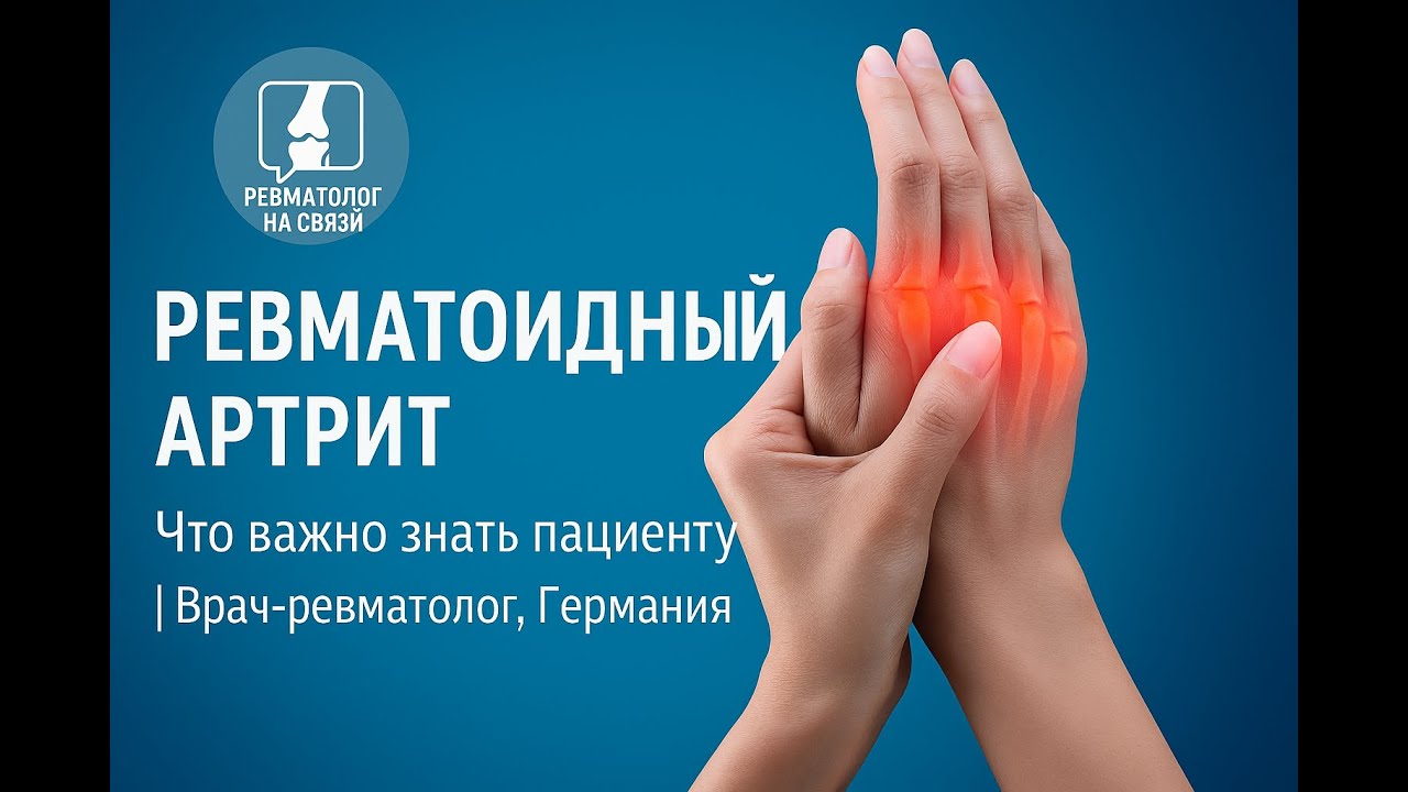 Ревматоидный артрит: диагностика, лечение и советы практикующего врача