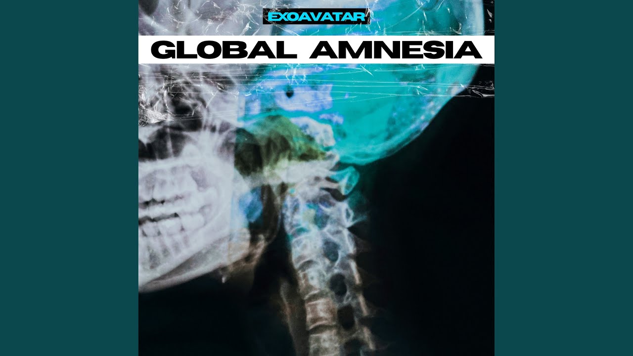 Global Amnesia
