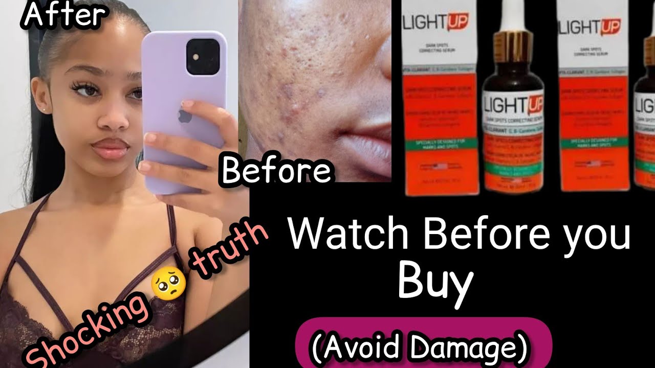 2022 #shockingreview🥺 Lightening serum|LIGHT UP SERUM,✨Review|light up serum for dark knuckles#serum