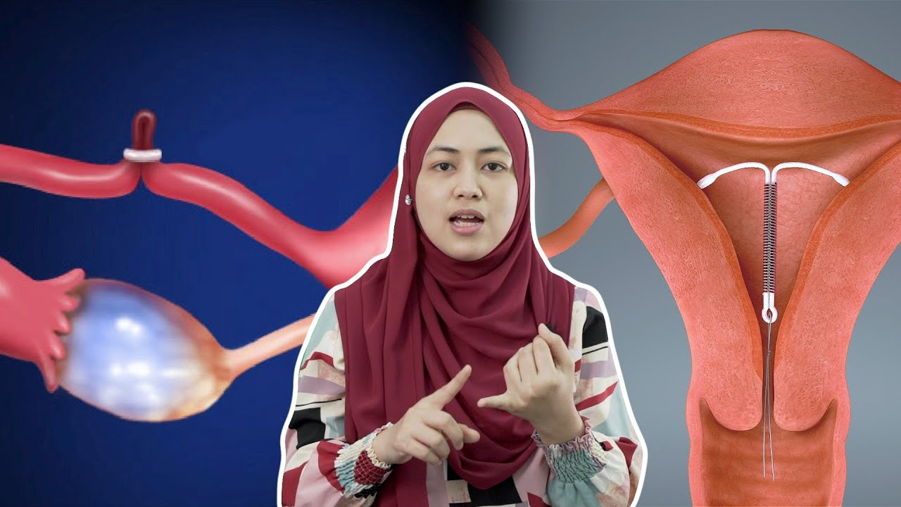 Cara Merancang Keluarga Selain Pil