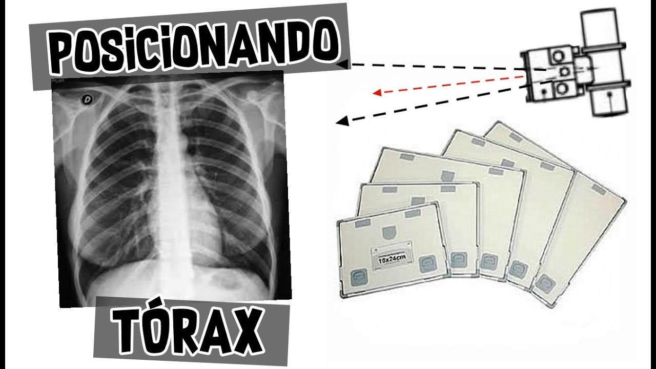 Posicionando Tórax