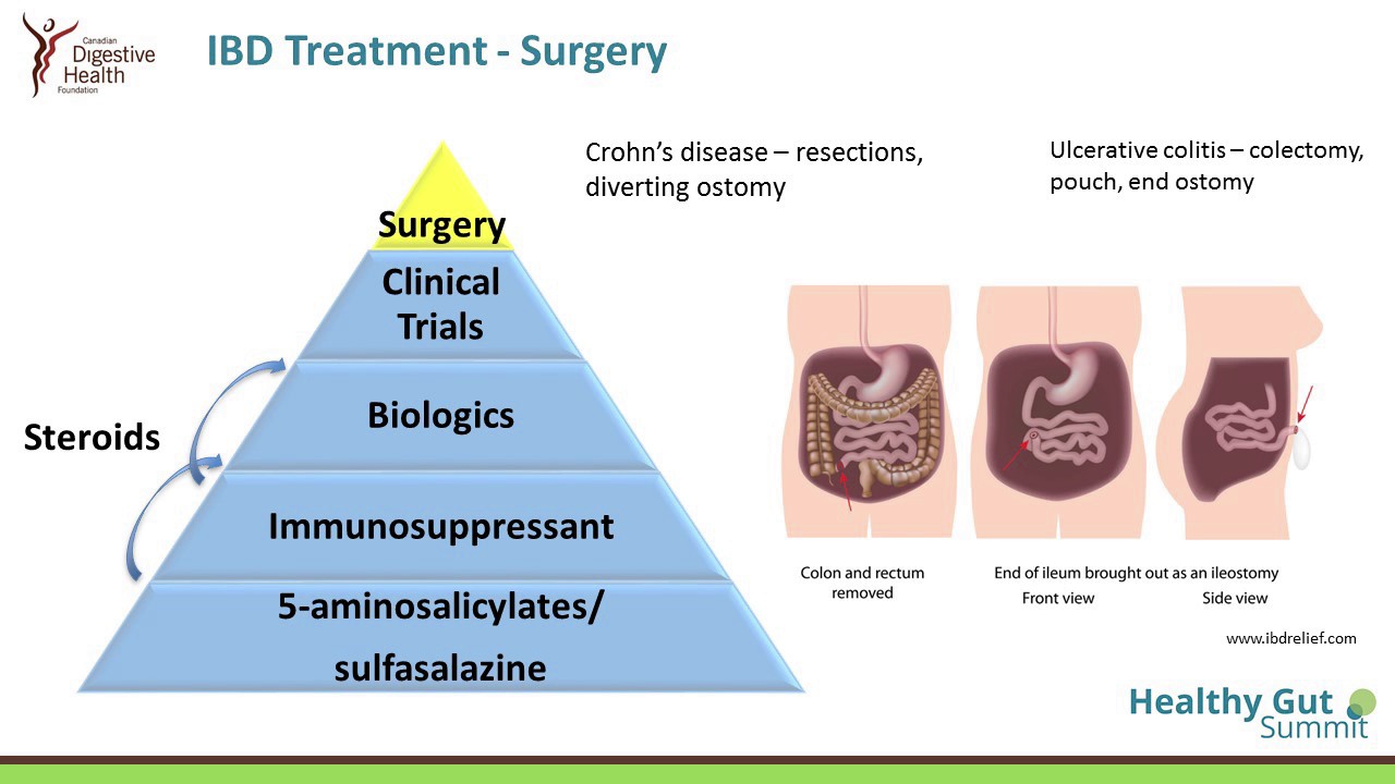 IBD Treatments and Pregnancy
