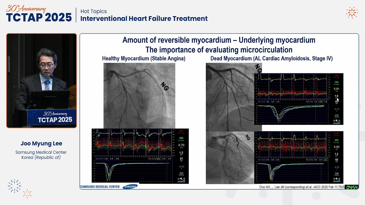 [TCTAP 2025] Hot Topics - Interventional Heart Failure Treatment