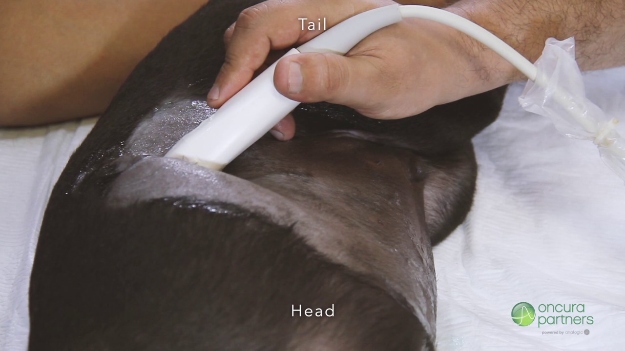 How To Perform an Ultrasound for the Canine Spleen