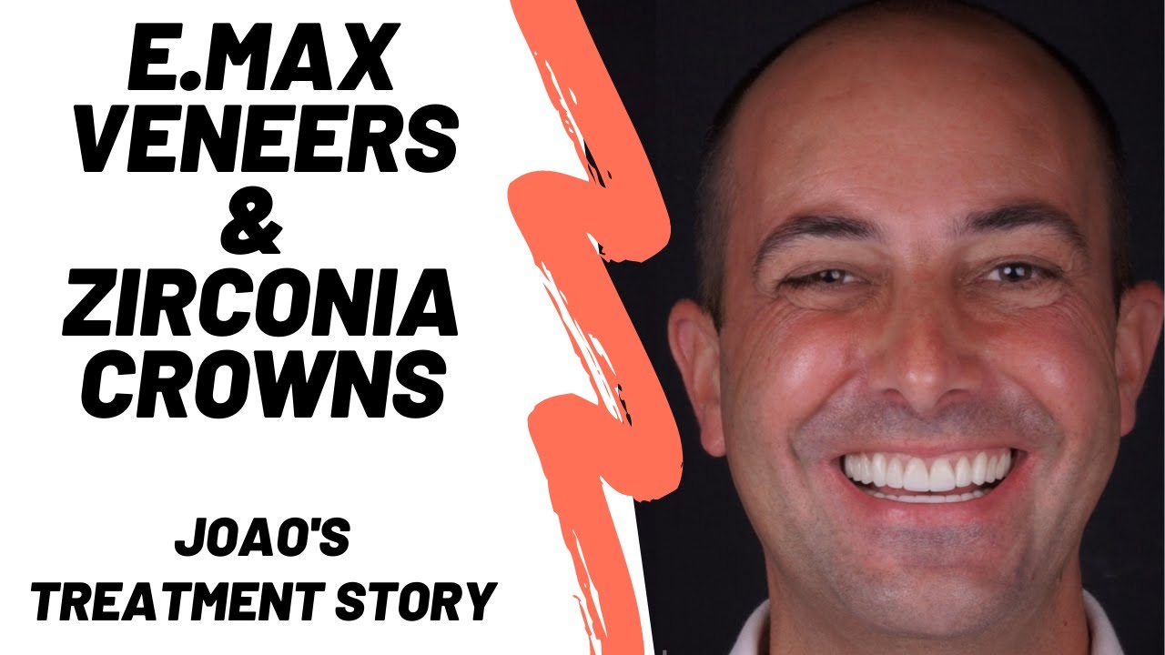 Emax Veneers and Zirconia Crowns in Turkey | Dental Excellence Turkey