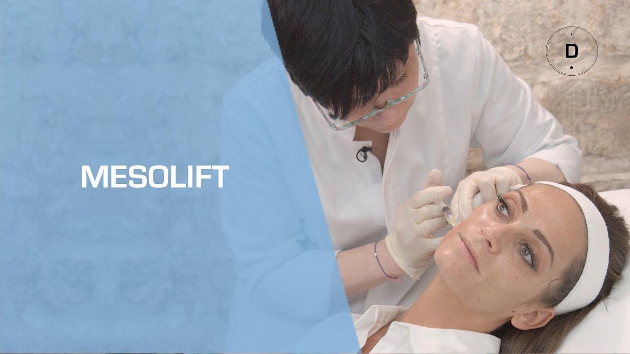Le Mésolift - Médecine esthétique