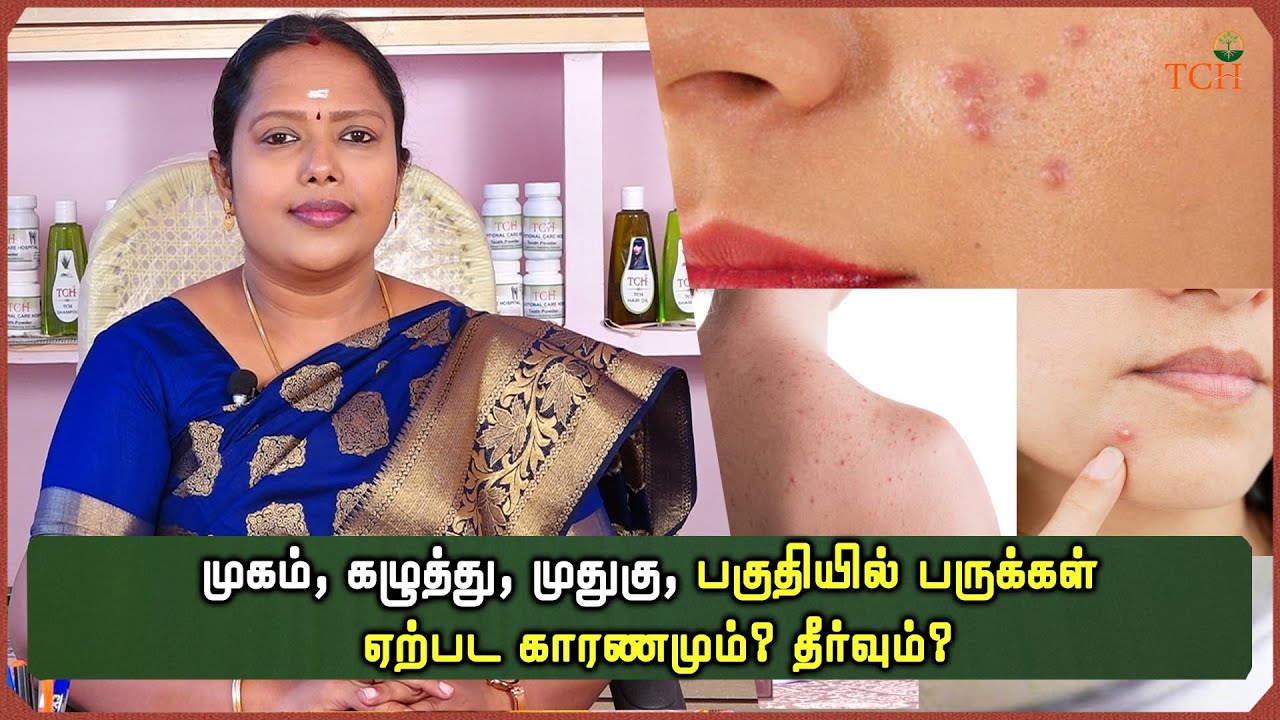 EPO - 025 முகம்,கழுத்து,முதுகு,பகுதியில் பருக்கள் ஏற்பட காரணமும்? தீர்வும்? - Dr.D.ராஜலக்ஷ்மி