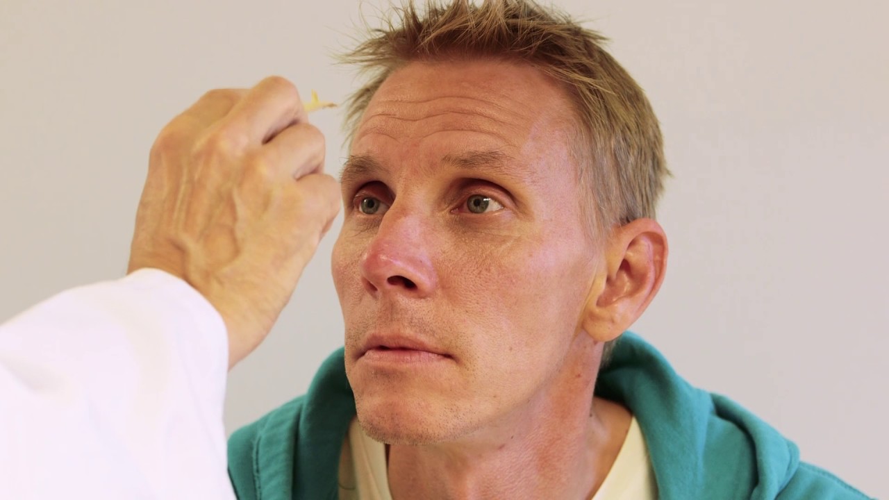 Orienterande neurologisk undersökning - rutinnervstatus